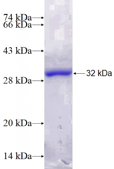 Recombinant Human CLASP1 SDS-PAGE