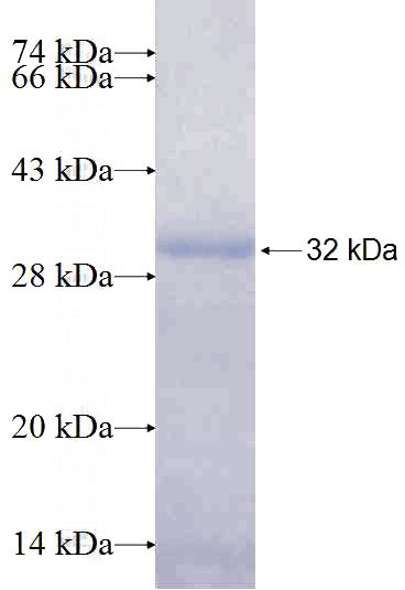 Recombinant Human RAD51 SDS-PAGE