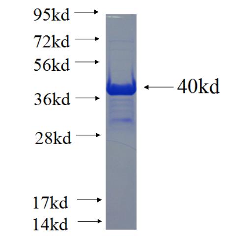 Recombinant human ANKRD13A SDS-PAGE