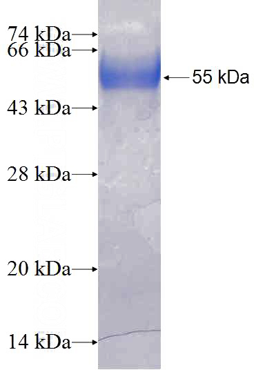 Recombinant Human ERBB2IP SDS-PAGE