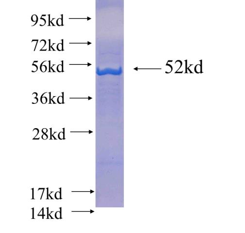 Recombinant human GMPPA(Full length) SDS-PAGE