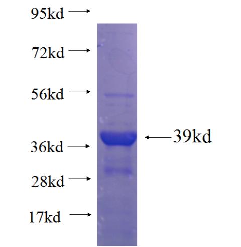 Recombinant Arabidopsis thaliana JAL33 SDS-PAGE