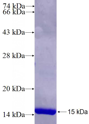 Recombinant Human EVI5 SDS-PAGE