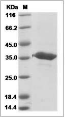 Human GGPS1 / GGPPS1 Protein (His Tag)