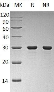 Human PDAP1/HASPP28 (His tag) recombinant protein