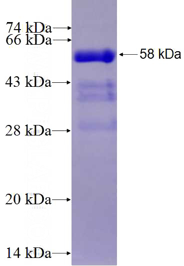 Recombinant Human DENR SDS-PAGE