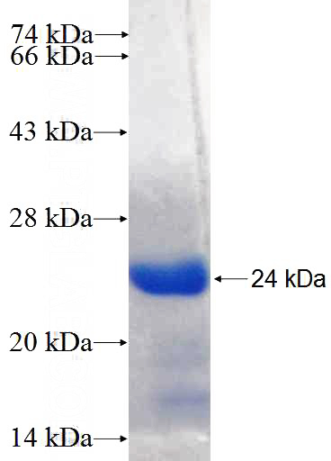 Recombinant Human KLHDC1 SDS-PAGE