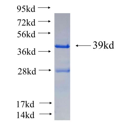 Recombinant human LITAF SDS-PAGE