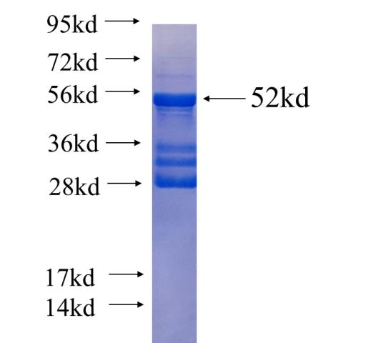 Recombinant human TRPC4 SDS-PAGE