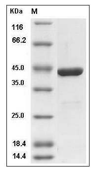 Human IDO2 Protein (His Tag) SDS-PAGE