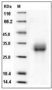 Mouse ALK-3 / BMPR1A Protein (His Tag) SDS-PAGE