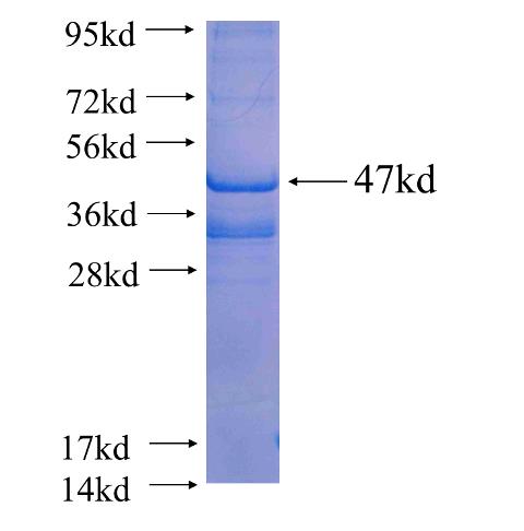 Recombinant human ARL8A(Full length) SDS-PAGE