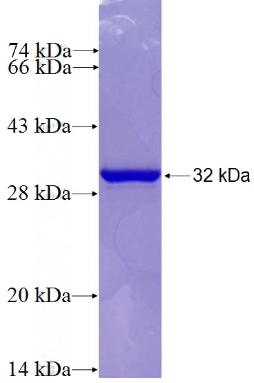 Recombinant Human FASN SDS-PAGE