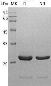 Human NPPB (His tag) recombinant protein