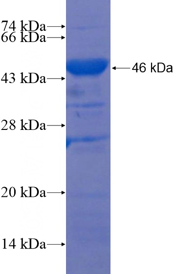 Recombinant Human SYNPO2 SDS-PAGE
