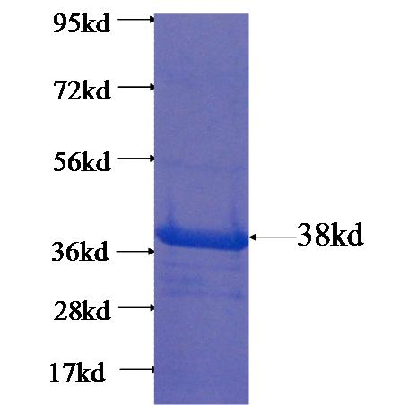 Recombinant human SPATA1 SDS-PAGE