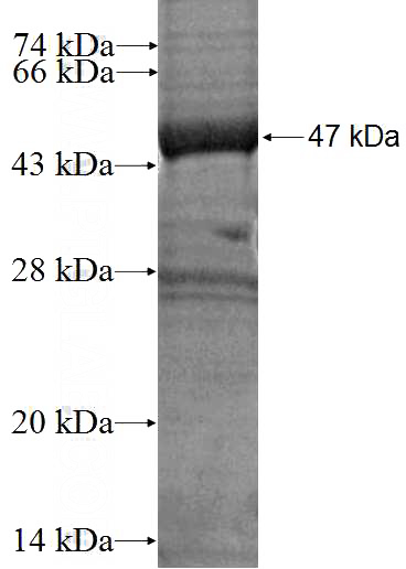 Recombinant Human HARS2 SDS-PAGE