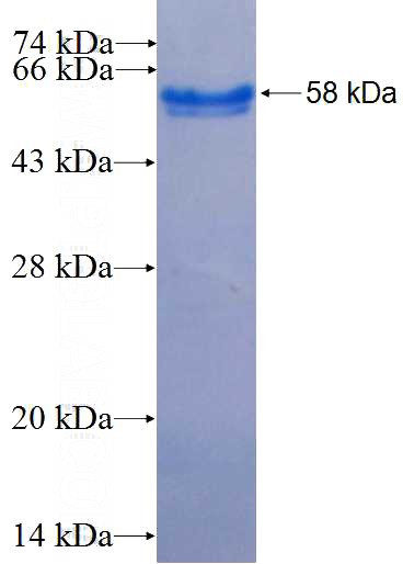 Recombinant Human AREG SDS-PAGE