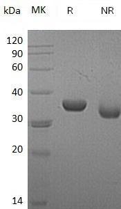 Mouse Ldha/Ldh-1/Ldh1 (His tag) recombinant protein
