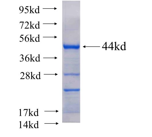 Recombinant human NEFL SDS-PAGE