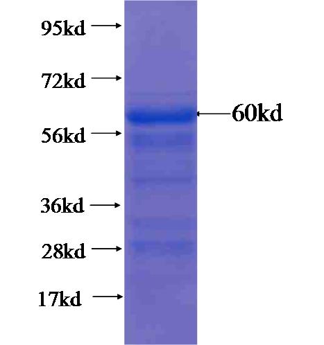 Recombinant human ANKRD57 SDS-PAGE