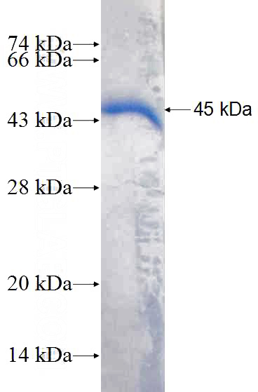Recombinant Human LCORL SDS-PAGE