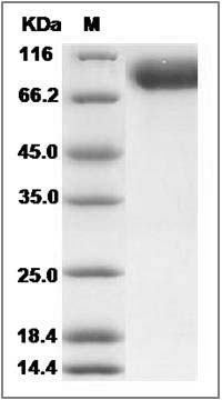 Rat CD10 / Neprilysin / MME Protein (His Tag) SDS-PAGE
