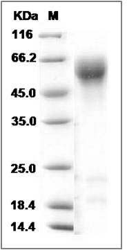 Human IL1R1 / CD121a Protein SDS-PAGE