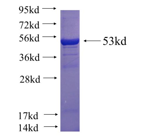 Recombinant human PSMA4 SDS-PAGE