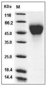 Mouse IL2RA / CD25 Protein (His Tag) SDS-PAGE