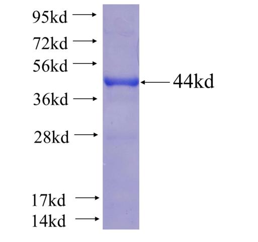 Recombinant human RGS7 SDS-PAGE