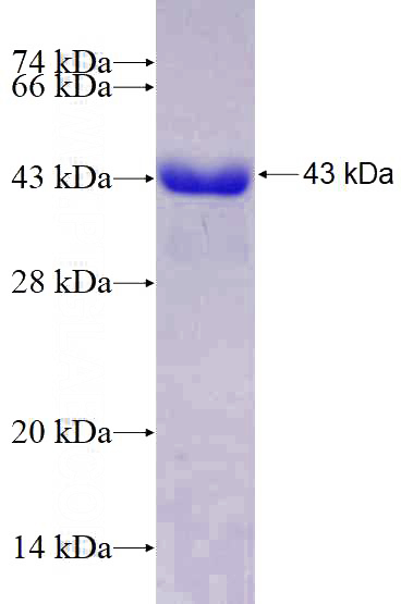 Recombinant Human SEMA4C SDS-PAGE