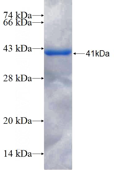 Recombinant Human HOXA5 SDS-PAGE