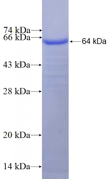 Recombinant Human GAB1 SDS-PAGE