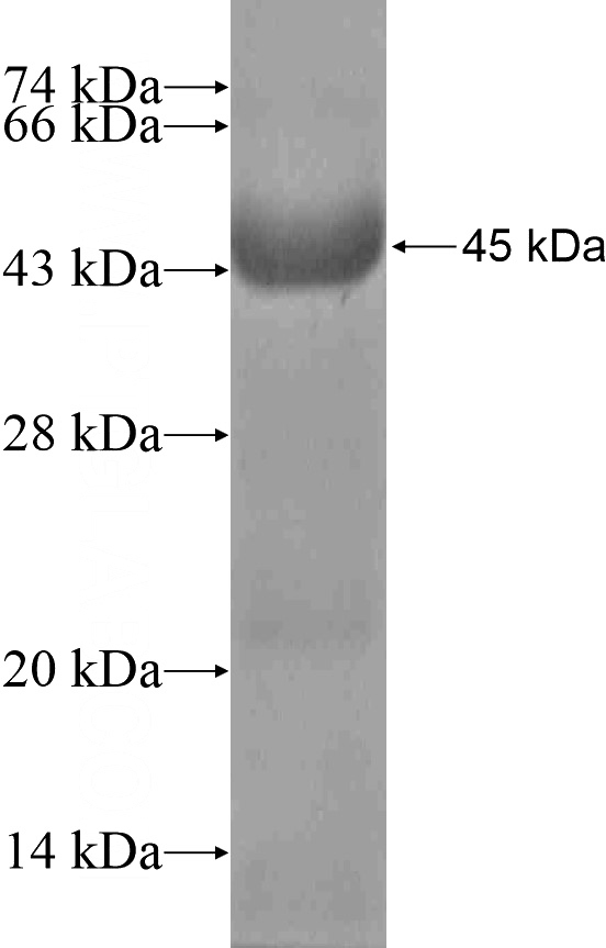 Recombinant Human EXOSC7 SDS-PAGE