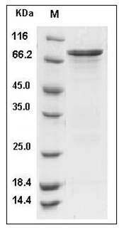 Human CHK1 / CHEK1 Protein (GST Tag) SDS-PAGE