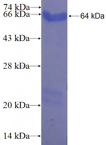 Recombinant Human C9orf82 SDS-PAGE
