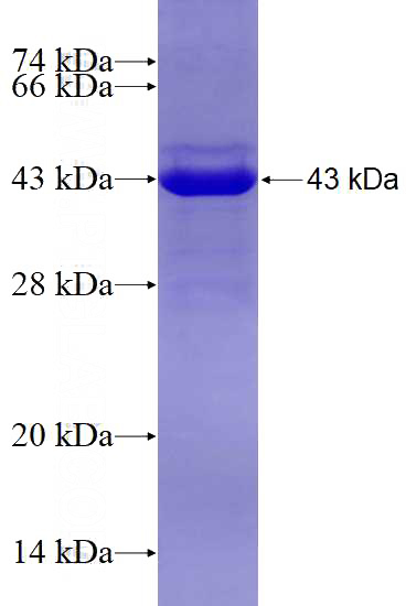 Recombinant Human HEMK1 SDS-PAGE