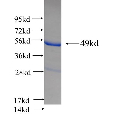 Recombinant human TAGLN SDS-PAGE