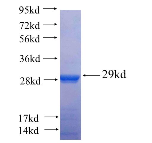 Recombinant human TIA1(Full length) SDS-PAGE