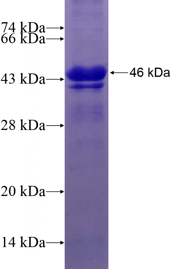 Recombinant Human GPKOW SDS-PAGE