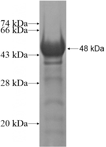 Recombinant Human SRRT SDS-PAGE