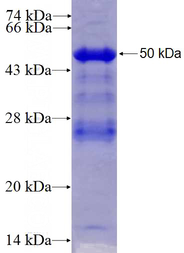 Recombinant Human IGFBP1 SDS-PAGE