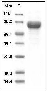 Human CD153 / CD30L / TNFSF8 Protein (Fc Tag) SDS-PAGE