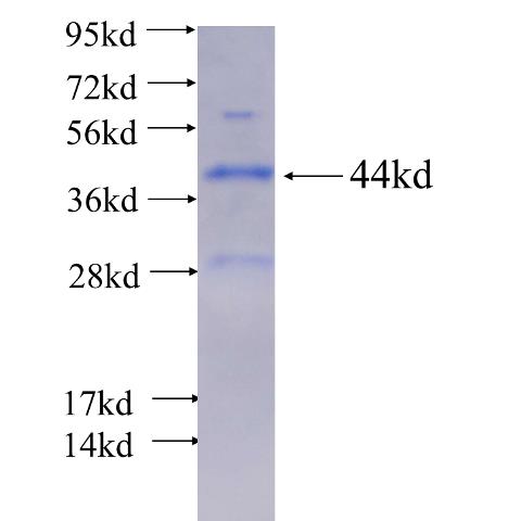 Recombinant human SHOC2 SDS-PAGE