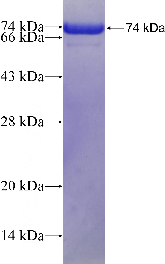 Recombinant Human SART3 SDS-PAGE