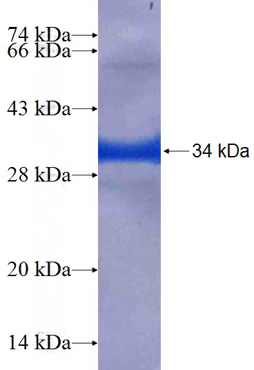 Recombinant Human COPS7A SDS-PAGE