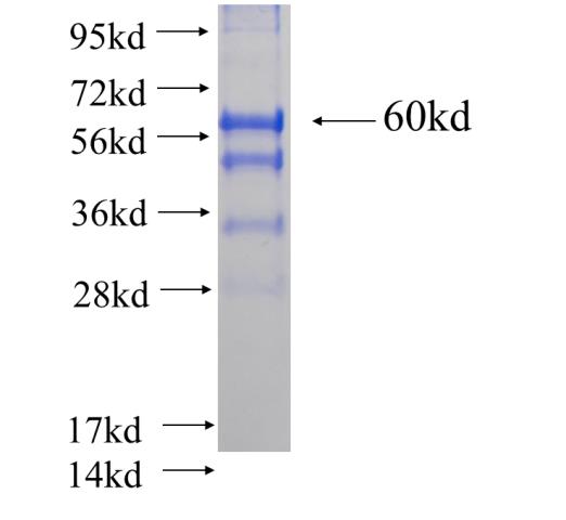 Recombinant human HNRNPA1 SDS-PAGE
