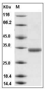 Human CMA1 / Chymase 1 Protein (His Tag) SDS-PAGE