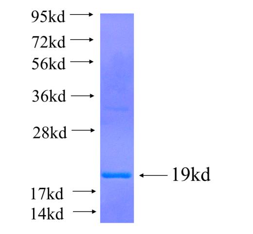Recombinant human UPK1B SDS-PAGE